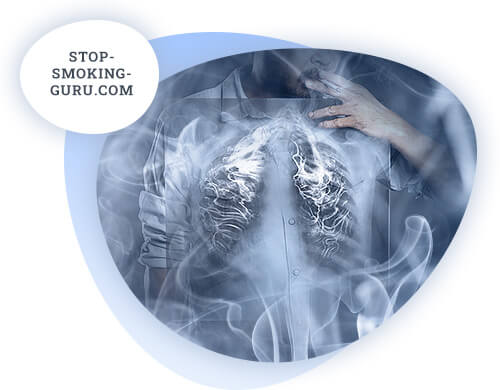 Lung cancer